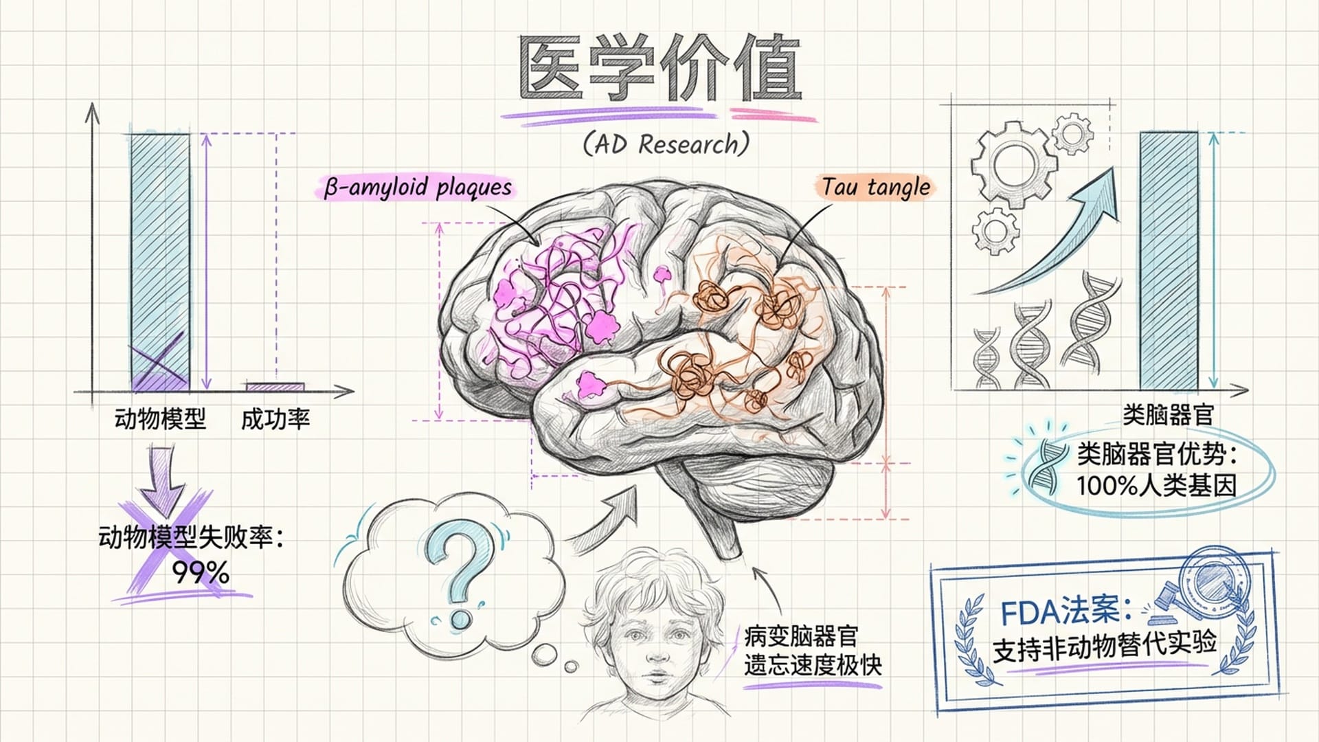 一个灰白色的类脑器官，部分呈现半透明，内部有彩色的β-淀粉样蛋白和Tau蛋白缠结的示意图。