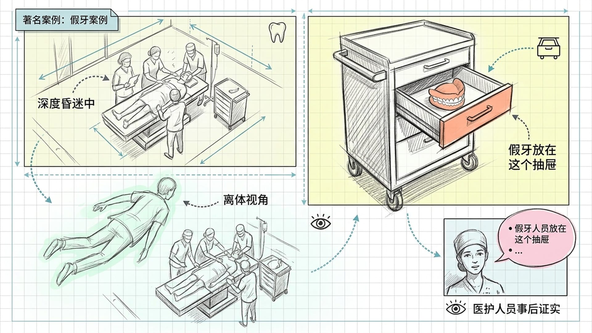 假牙案例——心脏骤停期间的清醒观察