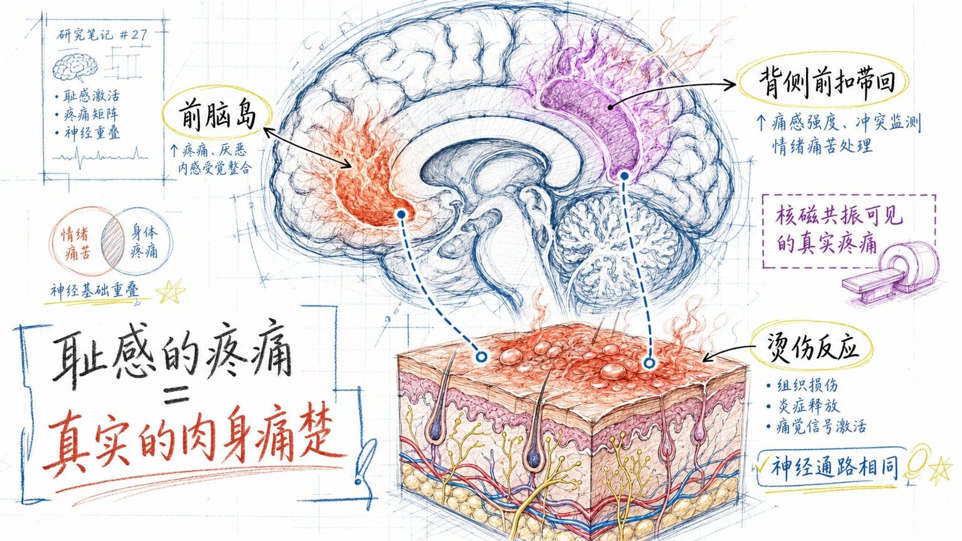 愧疚与耻感的神经机制对比