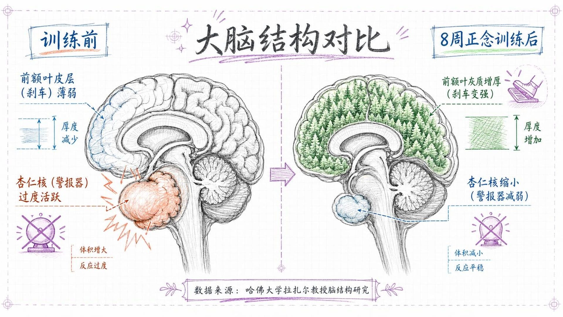 八周正念训练后，大脑结构发生可测量的改变
